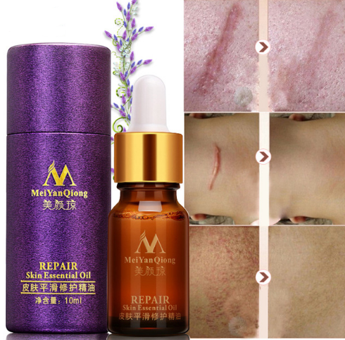Scar Skin Repair Essential Oil Lavender Essence Care Natural Skin Pure Remove Ance Burn Strentch Marks Removal Scar 10 ML